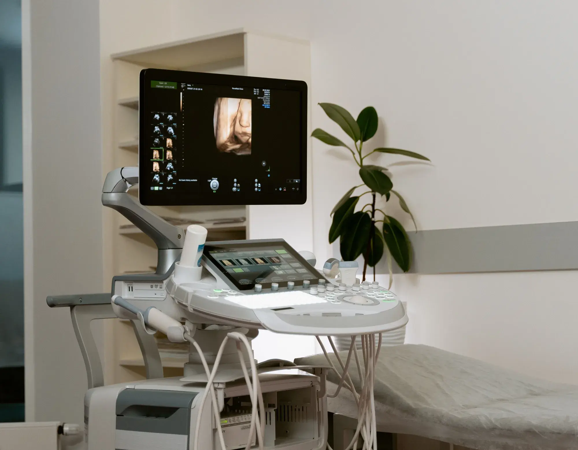 Korszerű ultrahang-diagnosztikai berendezés modern vizsgálóhelyiségben.